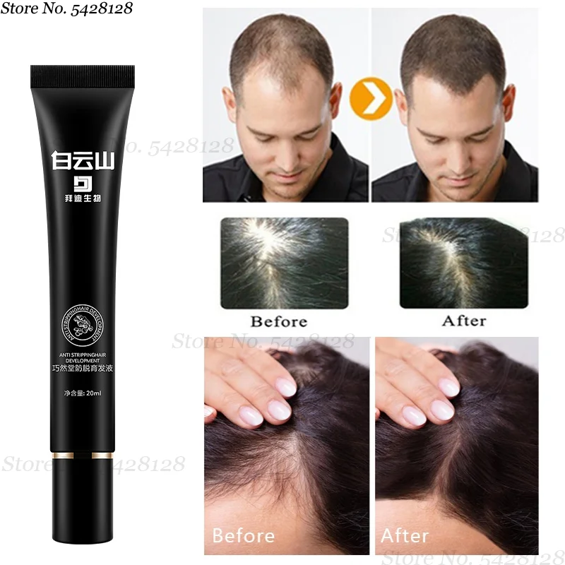 

Anti-hair Loss Liquid Increase Hair Density Fast Hair Growth Essential Oil Anti-hair Loss Treatment Hair Growth Hair Care