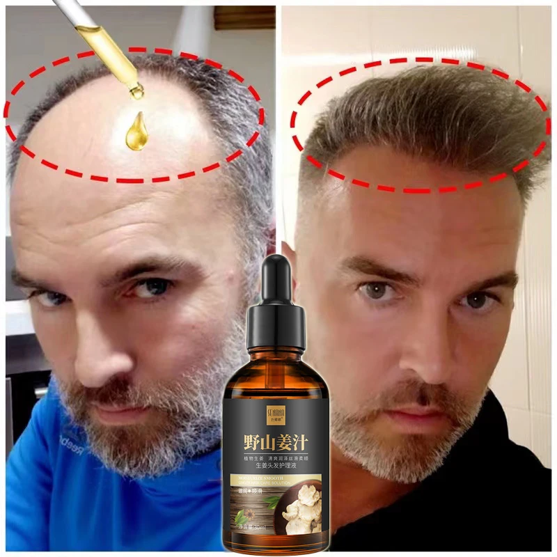 

Эффективное масло для роста волос, эффективный уход за длинными и толстыми волосами, травяная жидкость защищает от выпадения волос, лечит облысению, питает фолликул