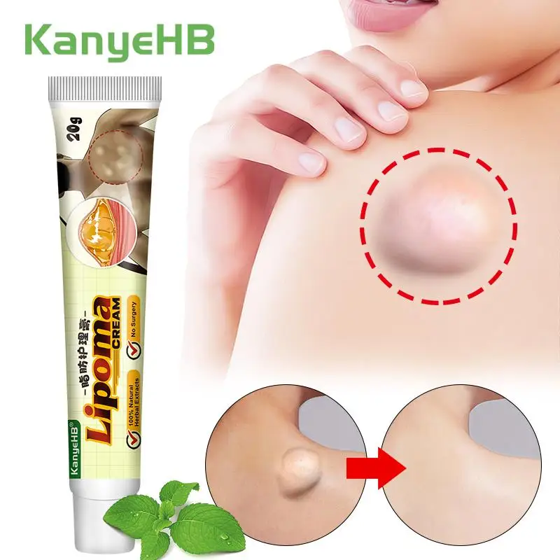 1 шт., крем Lipoma для снятия жира с кожи