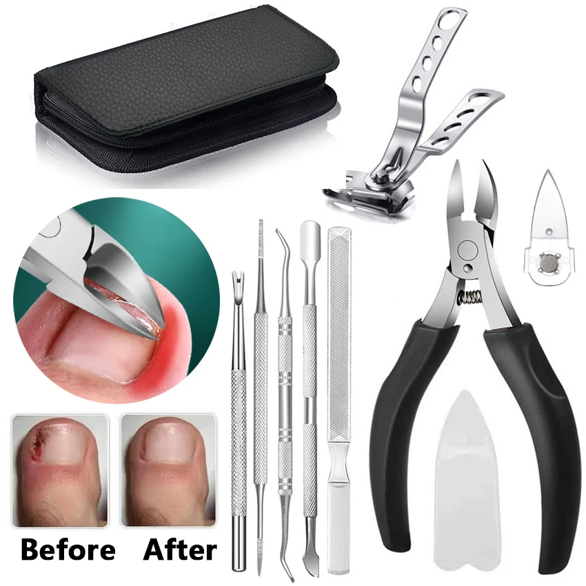 

Кусачки для ногтей на ногах для удаления омертвевшей кожи, кусачки для коррекции вросших ногтей, ножницы для кутикулы, ножницы для обработки кромок, толстые Инструменты для педикюра и ухода