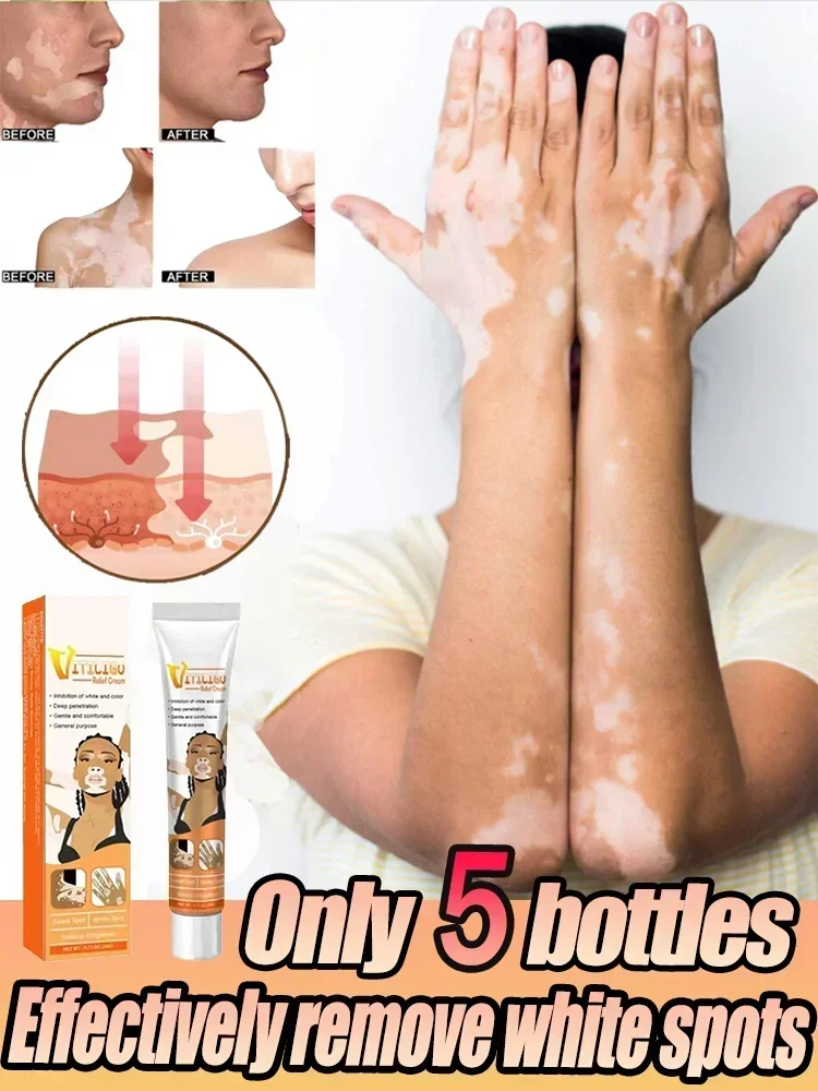 Мазь для удаления черных точек на коже 1006