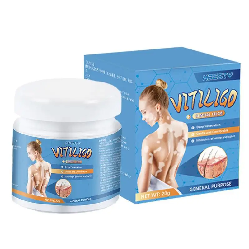 

White Spot Removal Cream 20g Skin Pigment Cream To Reduce For Soft And Comfortable Body Skin Non-covering For Adults
