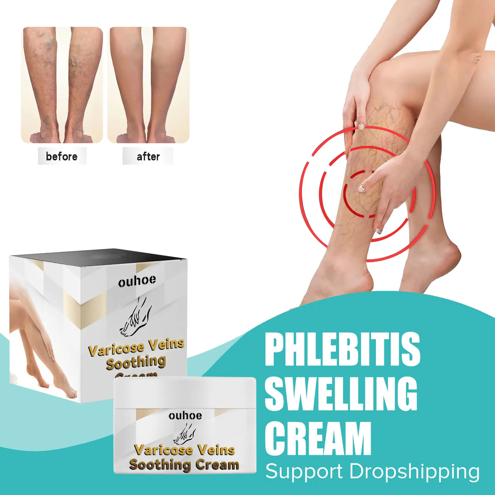 

Phlebitis Spider Pain Cream Angiitis Cure Anti Swelling Smoothing Redness Earthworm Legs Dilated Vasculitis Treatment Ointment