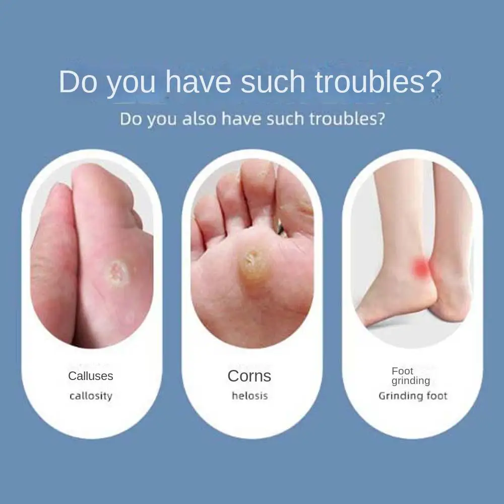 Предотвращение мозолей волдырей инструменты для педикюра подушечки ног