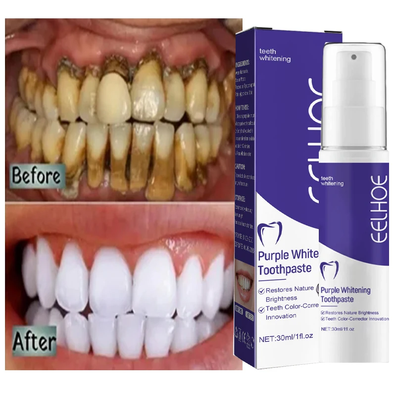Teeth Cleansing Whitening Toothpaste Removes Cigarette Stains Neutralizes Yellow Tones Dental Fresh Bad Breath Mousse Toothpaste