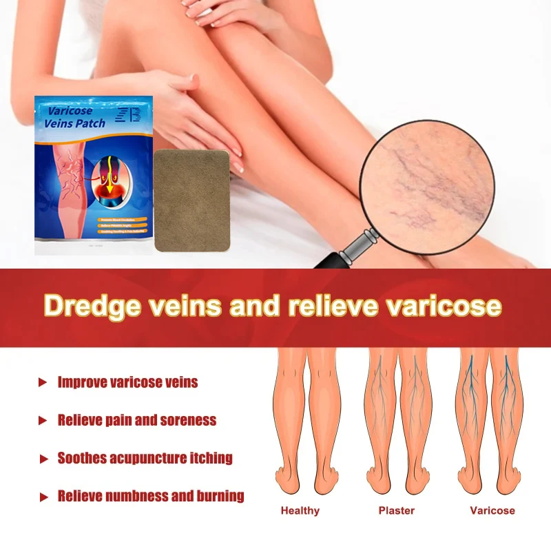 6/8/12 шт. лечение варикоцеле васкулита ног паука с венозным пластырем для снятия