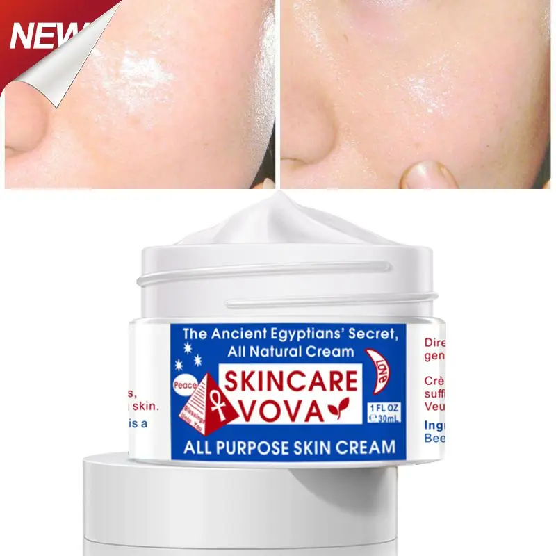 

Improves Skin Tone Spot Cream Brightens Complexion Moisturizing Nourishing Effective Face Cream Popular Skincare Product