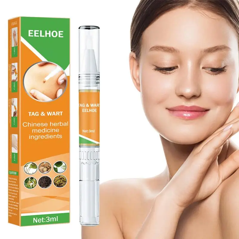 

Skin Tags Remover Against Moles Removal Wart Corn Remover Pen Anti Foot Corn Skin Care Liquid Easy To Use Natural Ingredients