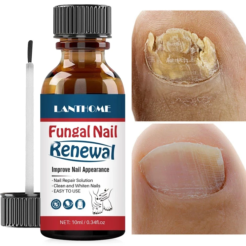 

Nail Repair Fluid Anti-Fungal Nail Polish Cleansing Nourishes Nails Rejuvenating Discoloration Regenerating Toenail Care Serum