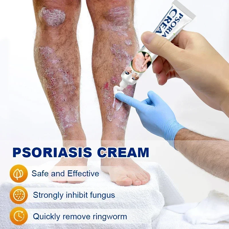 Увлажняющий крем от псориаза натуральный Восстанавливающий Антибактериальный