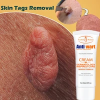 20ml skin tag remover cream warts remover cream moles wart treatment ointment herbal extract foot corn cream acne warts ointment