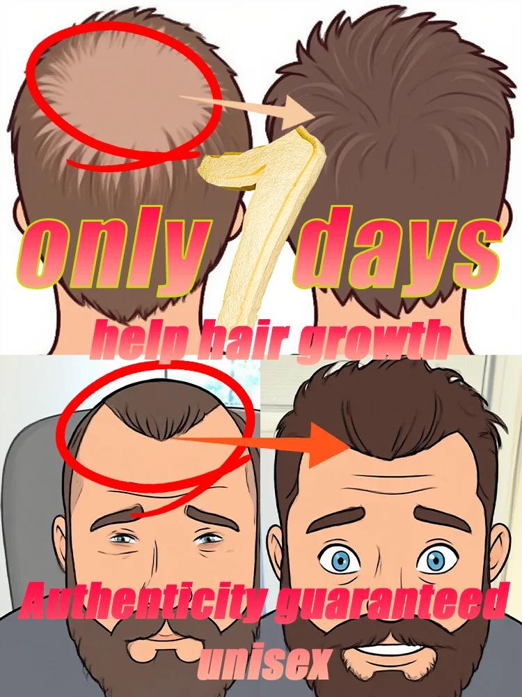 

Имбирный спрей для роста волос