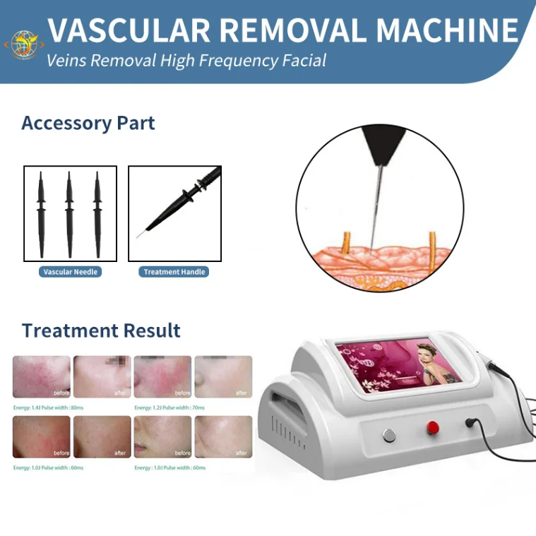 

Laser Machine Cheap R-F High Frequency Vascular Therapy Machine Red Blood Vessels Spider Vein Removal R-F