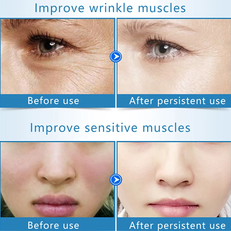 5 Бутылочек Коллагеновых Шариков Чистый Натуральный Шелковый Протеин