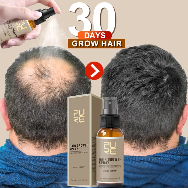 Ginger Hair Growth Spray Products  Anti Hair Loss Serum Scalp Treatment Fast Grow Prevent Baldness Repair Thin Damaged Hair Care