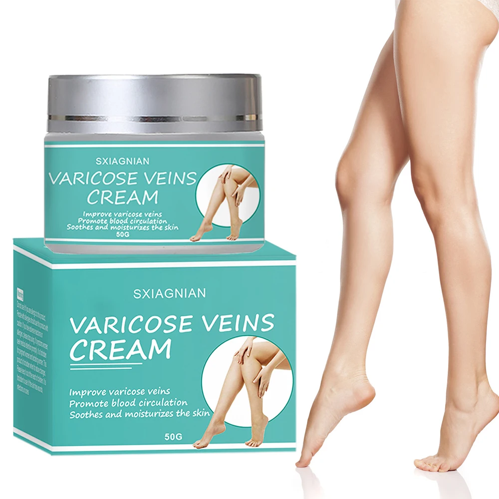 

50g Varicose Vein Cream Relief Phlebitis Angiitis Remedy Pain Herbal Vasculitis Varicose Vein Disease Spider Veins Relieve