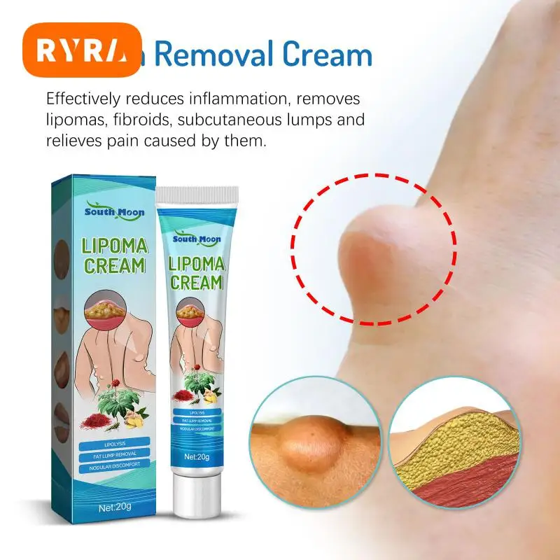 

Natural Plant Lipoma Removal Cream Extract Treatments Plaster Removes Lipomas Fibroids Subcutaneous Lumps Pain Relief Skin Care