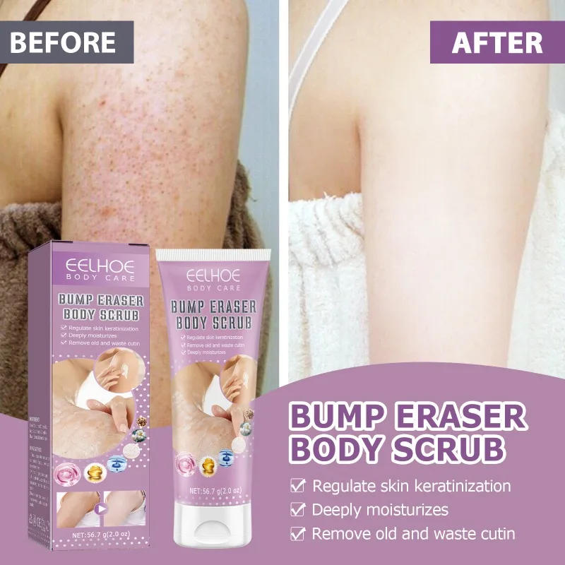 

Remove Chicken Skin Body Scrub Smooth Skin Cleansing Lotion Moisturize Brighten Body Care Cream Improve Rough Skin Scrub Cream