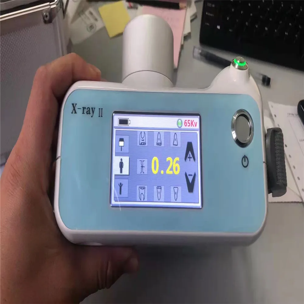 Рисунок 6 - Портативный рентгена