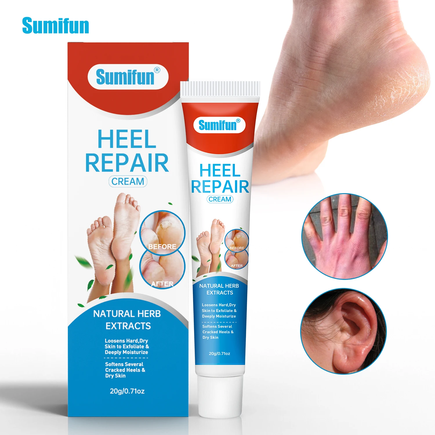 

1Pc 20g Anti-Drying Crack Heel Cream Foot Cracked Removal Dead Skin Moistening Balm Repair Chapped Ointment Hand Health Care