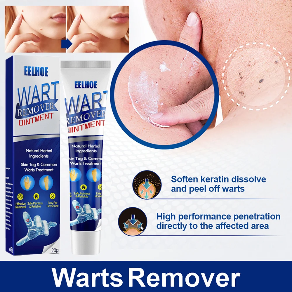 

Hot Mole Tag Wart Remover Ointment Antibacterial Solution Remove Fleshy Particle Cre Moisture-Cream Dark Spot Remove