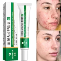 20g effective acne removal cream treatment herbal acne spots oil control anti aging moisturizing whitening acne cream skin care