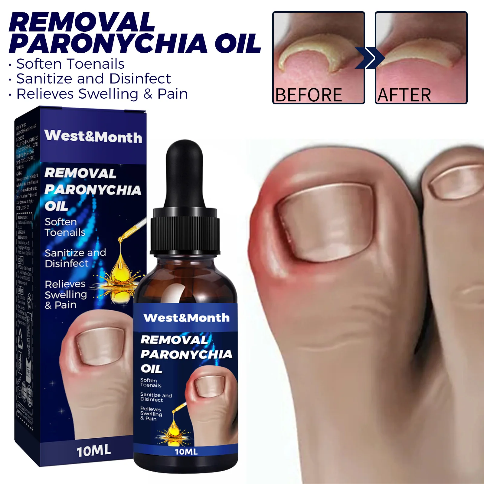НОВОЕ 10 мл масло для ухода за ногтями используемое удаления внутреннего роста