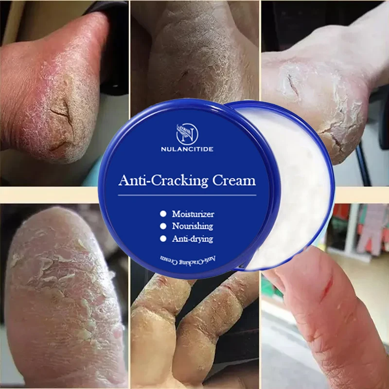 

85g Anti Crack Foot Cream Dryness Foot Mask Heel Cracked Repair Cream Hand Mositurizing Removal Callus Dead Skin Hands Feet Care