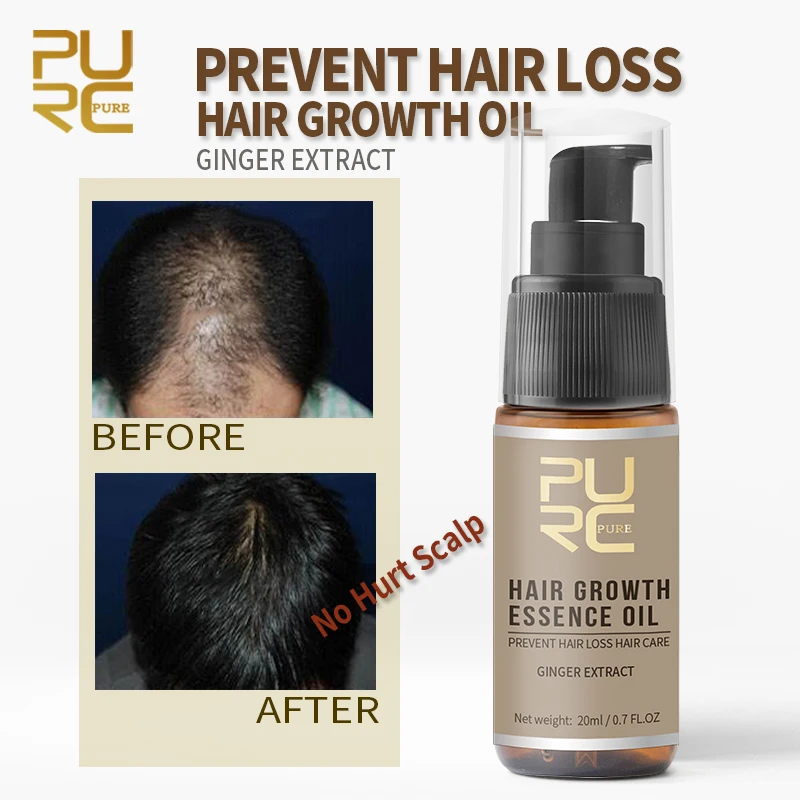 

PURC Ginger Hair Growth Products Fast Growing Spray Scalp Treatment Oil Beauty Health Hair Care For Men Women 20ml