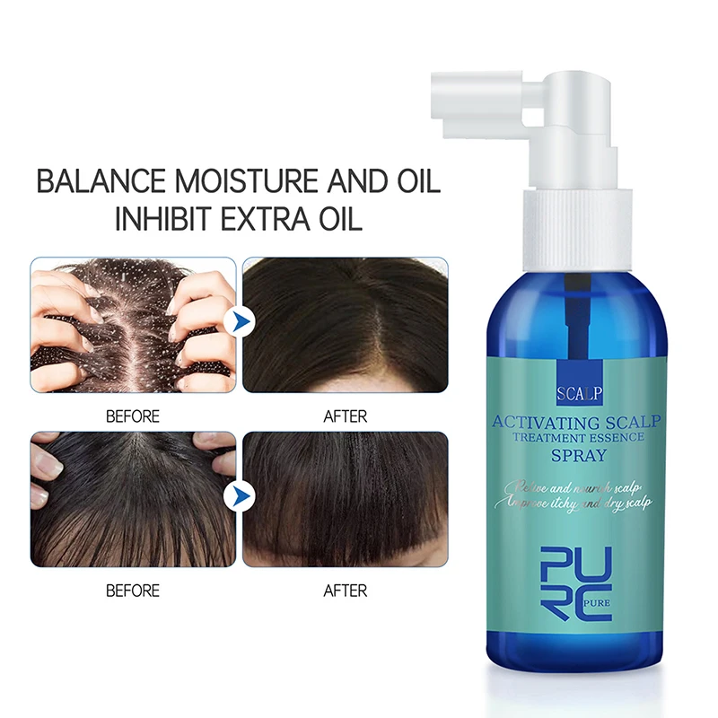 

Fast Hair Growth Essence Hair Oil Scalp Treatment Anti-Dandruff Exfoliating Prevent Hair Loss Hair Care Products 60ml