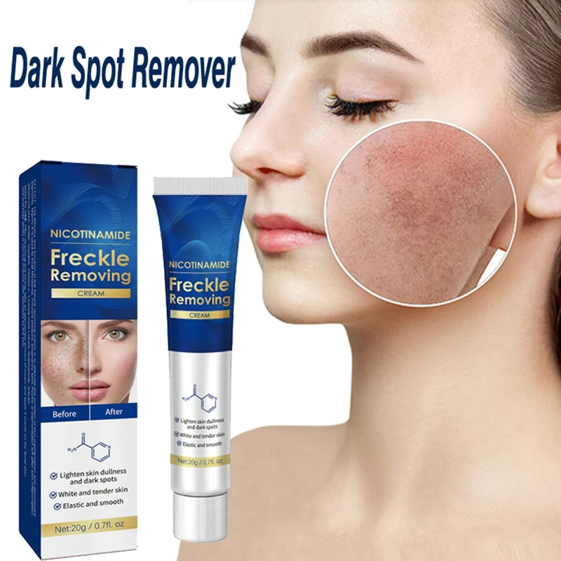 

Dark Spot Remover for Face Removing Freckle Chloasma Senile Plaques Sunburn Cyasma Chorioplaque Freckle Cream