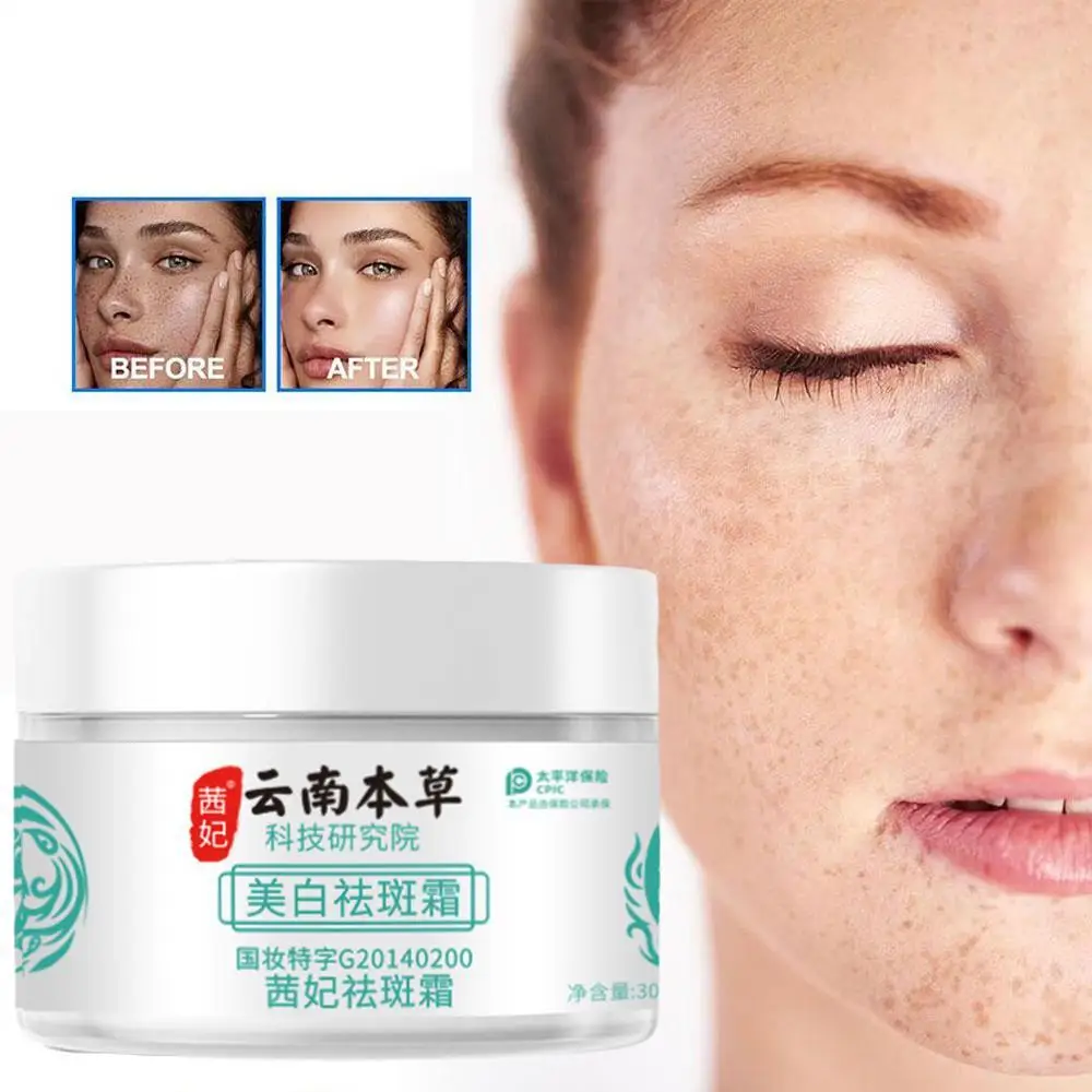 

30g Herb Powerful Whitening Freckle Cream For Dark Spot Correcting Face Moisturizing Brightening Skin Care Beauty