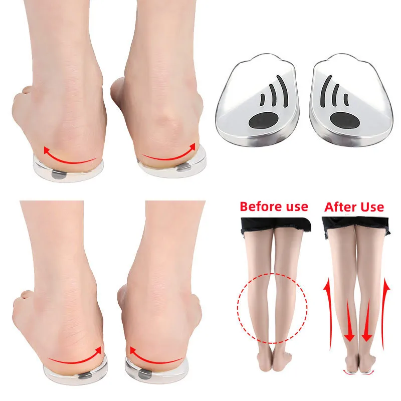 1Pair Magnet Silicone Massage Insoles Gel O/X Type Orthopedic Heel Pads Corrector Valgus Varus Foot Shoe Insole Insert Feet Care