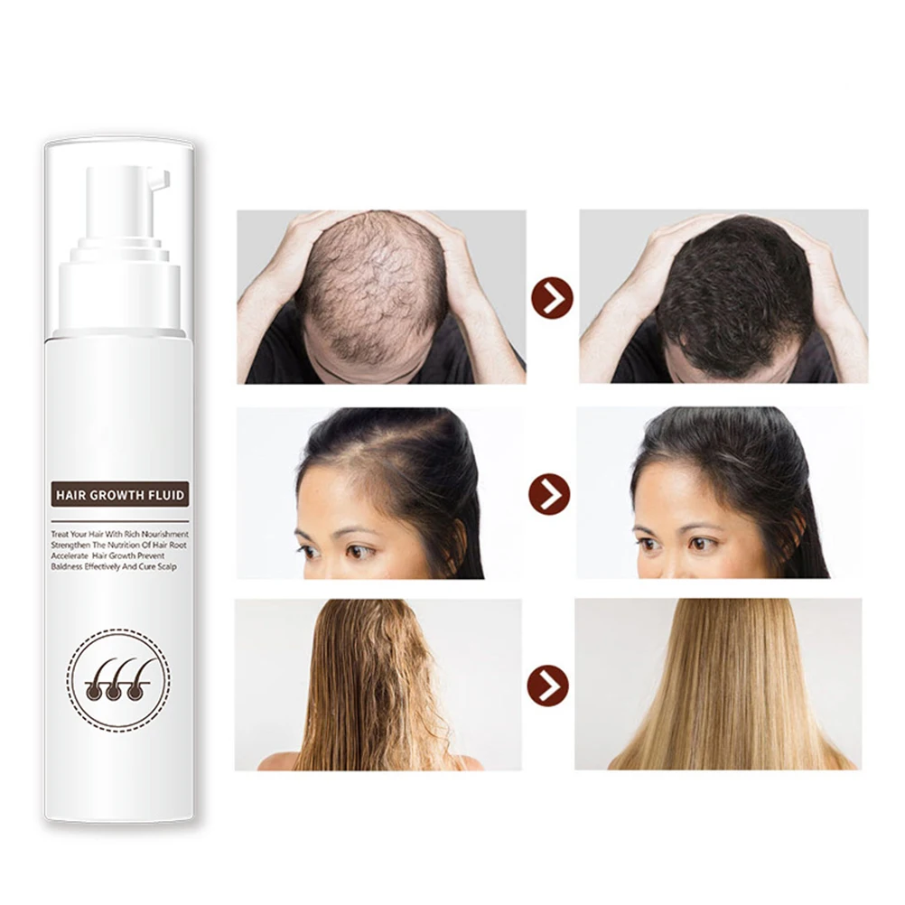 

30ml Hair Growth Fluid Anti Hair Loss Nourishing Hair Serum Hair Care