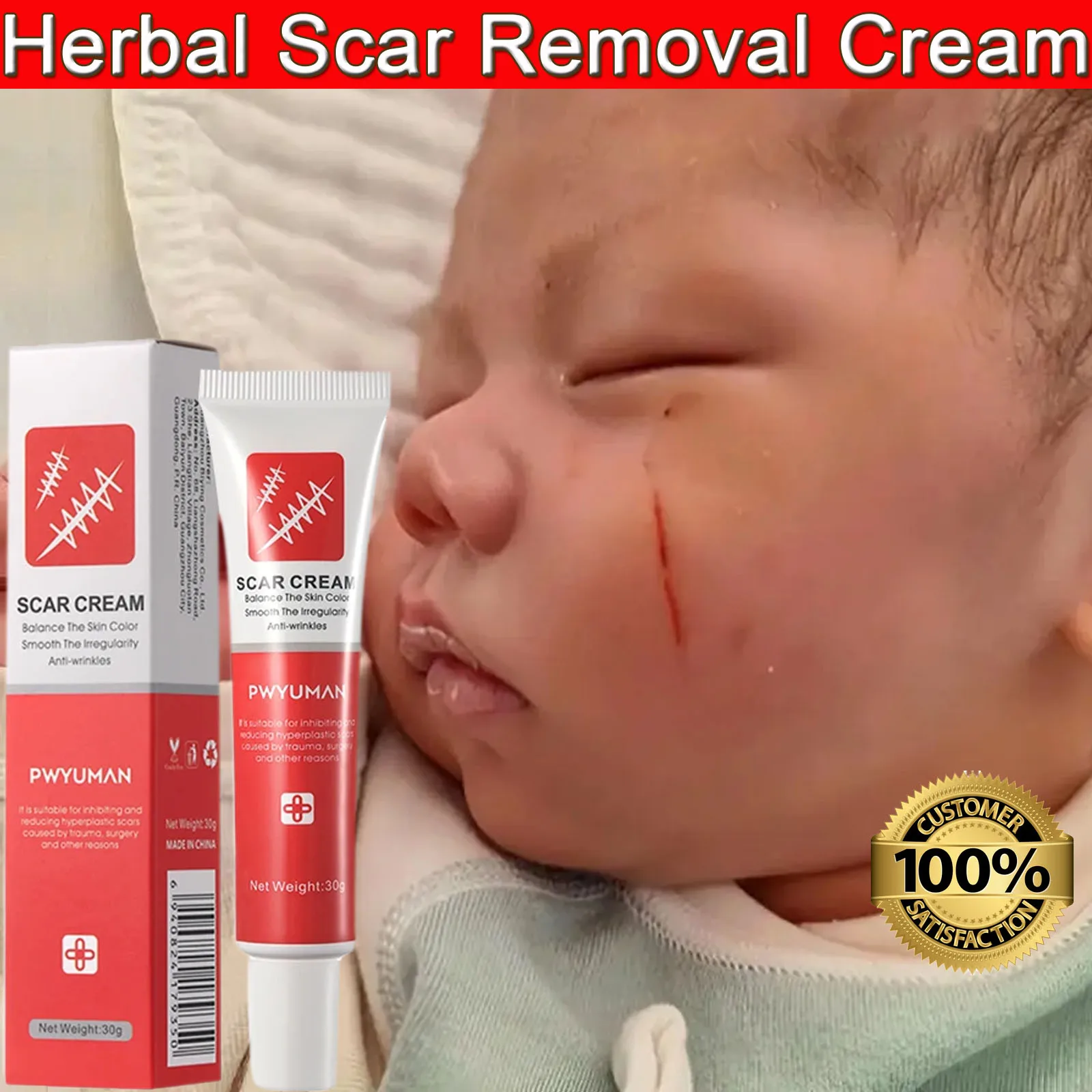 Крем для быстрого удаления шрамов от акне и восстанавливающий гель лечение