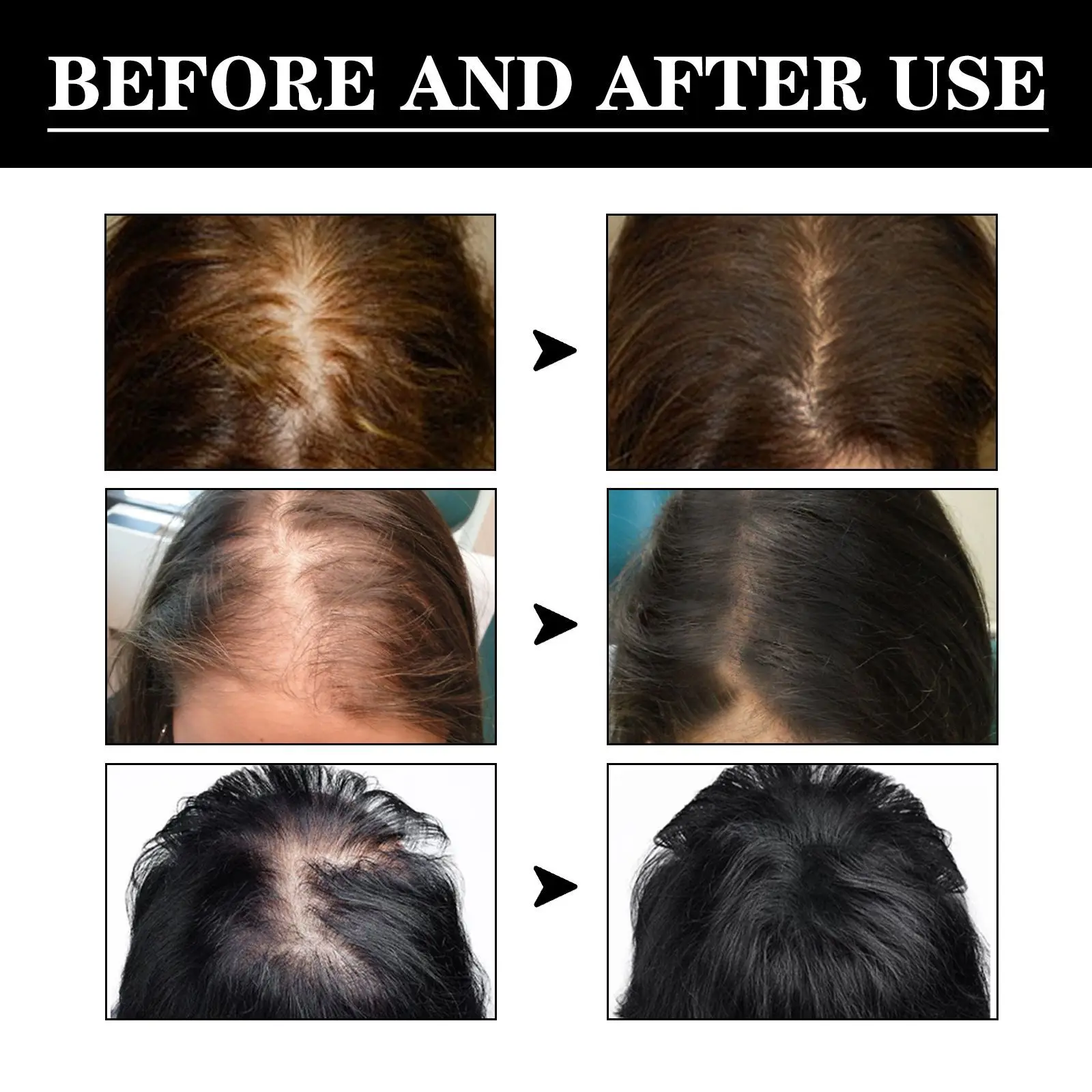 

Anti Hair Loss Dense Hair Essence Repairing Hair Root Dense Hairline Strong Firm Nourishing Essence Hair Treatment Hair Growth