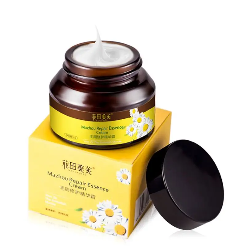 

30g Facial Body Ichthyosis Anti-Wrinkle Treatment Repair Essence Cream Curing Chicken Fish Scale Snake Skin Anti Drop Shipping