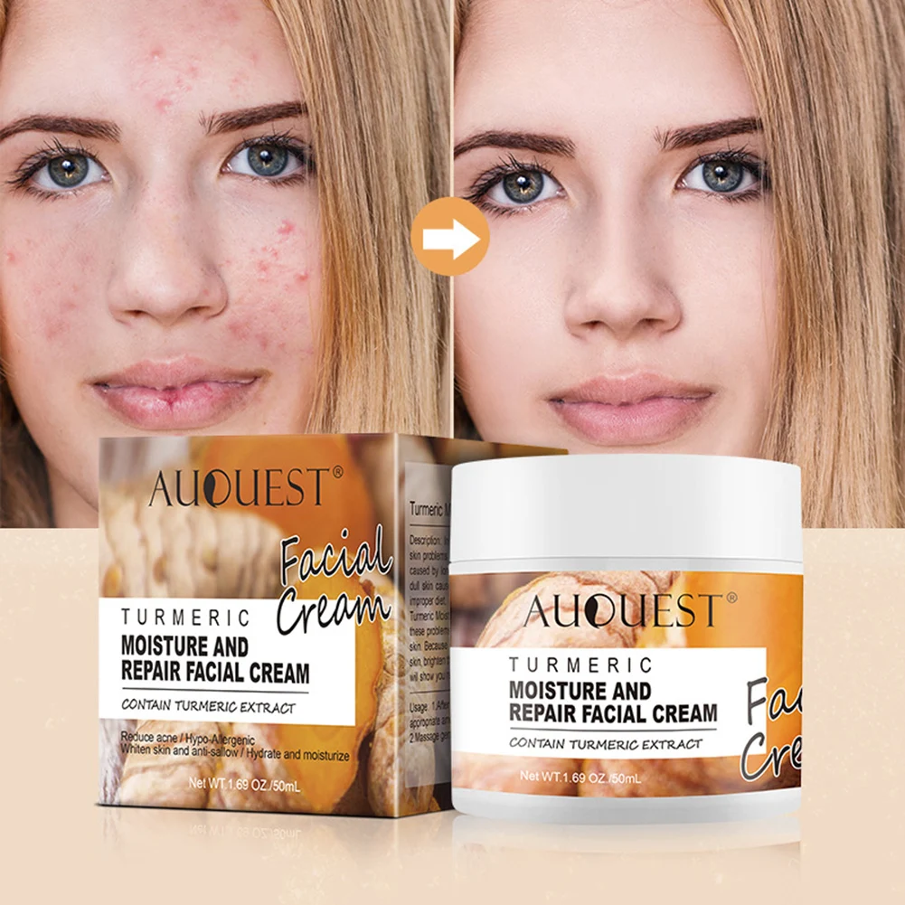 

5Pcs Turmeric Skin Care Sets Facial Serum Acne Treatment Moisturize And Repair Cream Blackhead Cleanser Clay Mask Kit For Women