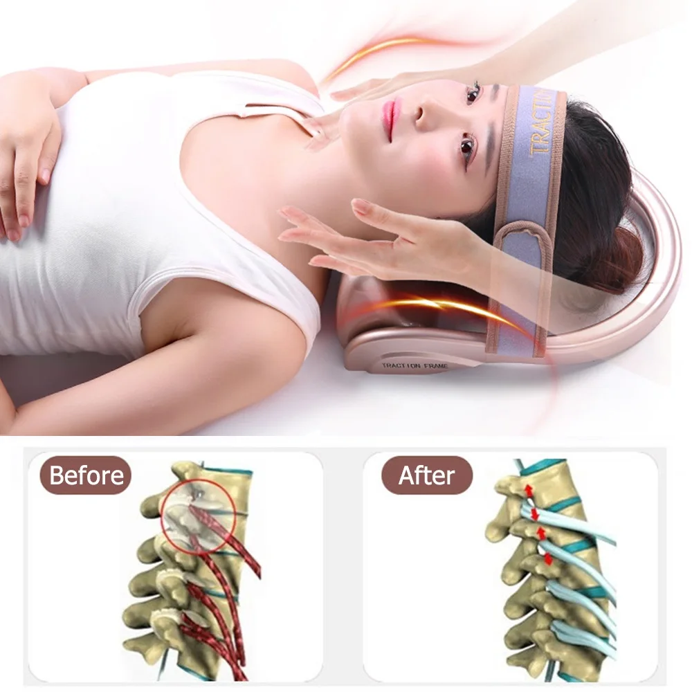 Надувной шейный Тяговый тренажер для растяжки осанки поддерживающий воздушный