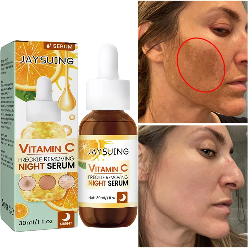 Vitamin C Whitening Freckle Remove Face Serum Lighten Dark Spot Melasma Improve Dull Repairing Brightening Skin Beauty Cosmetics