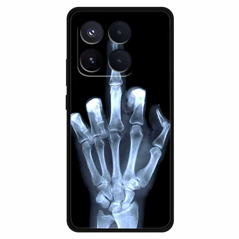 Фото Чехол для Xiaomi 17T: Роскошный Мягкий Силиконовый Чехол, Милый Защитный Противоударный Чехол для Xiaomi 17T 5G №4