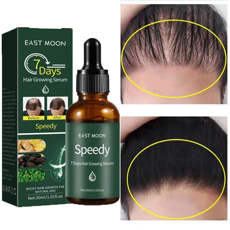 

7 Days Ginger Hair Growth Serum Products Anti Hair Loss Treatment Fast Growing Repair Damaged Nourish Hair Beauty for Men Women