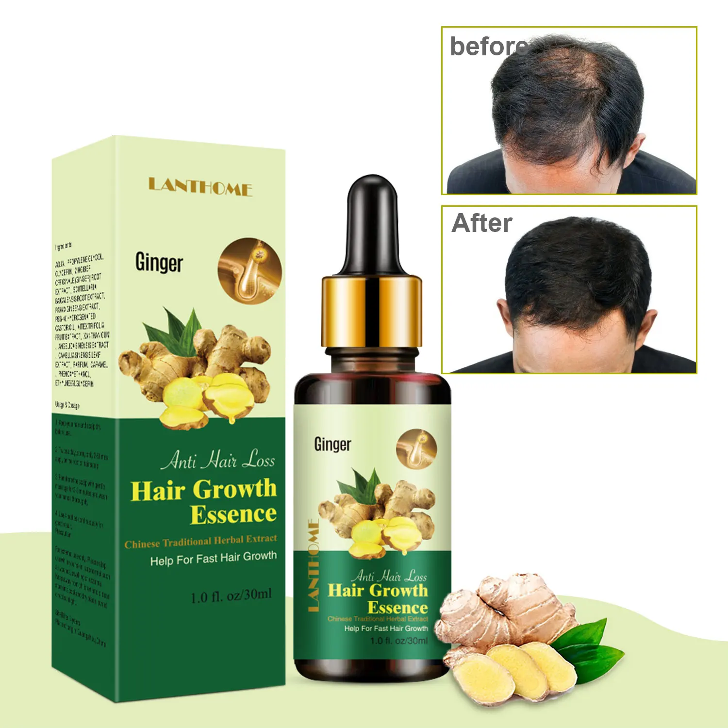 

30ml Hair Growth Essential Oils Ginger Fast Growing Hair Serum Products For Men Women Prevent Hair Loss Oils Scalp Beauty Health