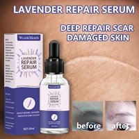 after the operation in the essential oil beauty salon lavender repair essential oil liquid dilute the acne pit and moisturizing