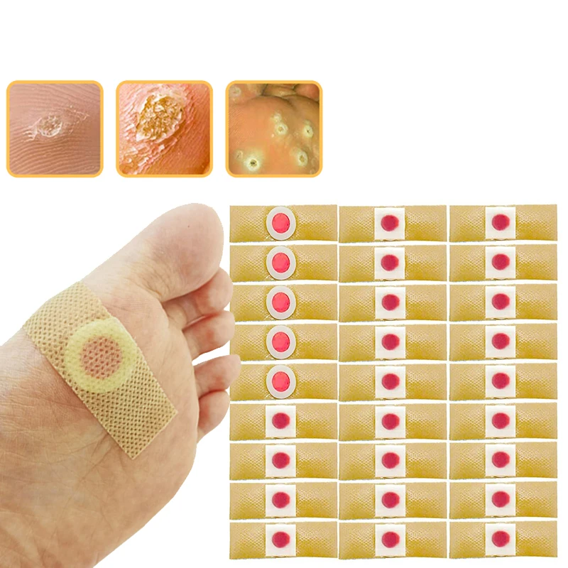 

Пластыри медицинские для удаления мозолей, бородавок и мозолей, 24 шт.