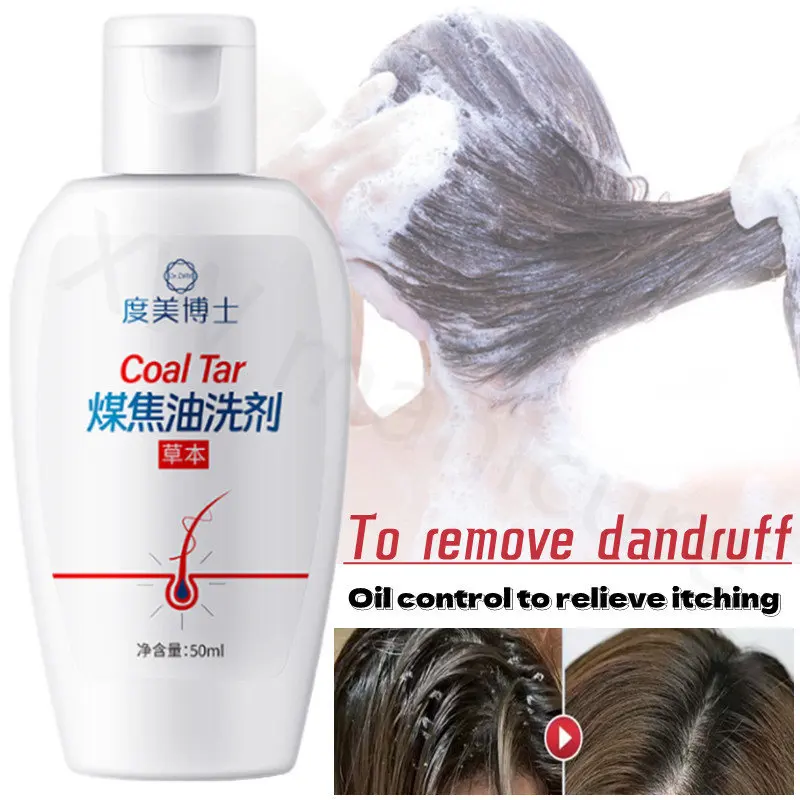 

Hair Treatment Hair Cleaning Care Shampoo Lotion Refreshing Oil Control Improve Dandruff Anitchy Rough Hair Shampoo 50ml