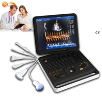 laptop full digital usg machine ultrasound eco doppler portable