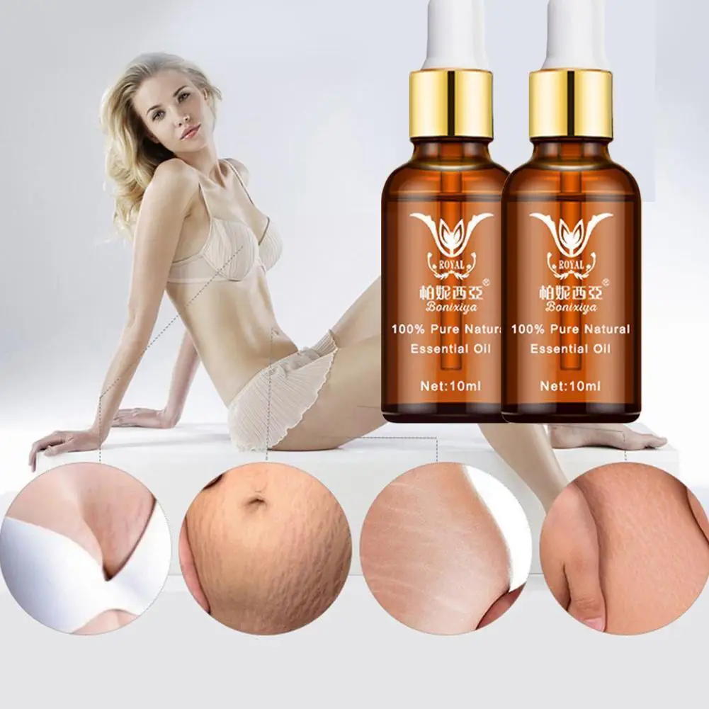 

Stretch Marks Remover Essential Oil Natural Safety Treatment Cream For Stretch Mark Removal Maternity Slackline Skin Care 1 O8R0