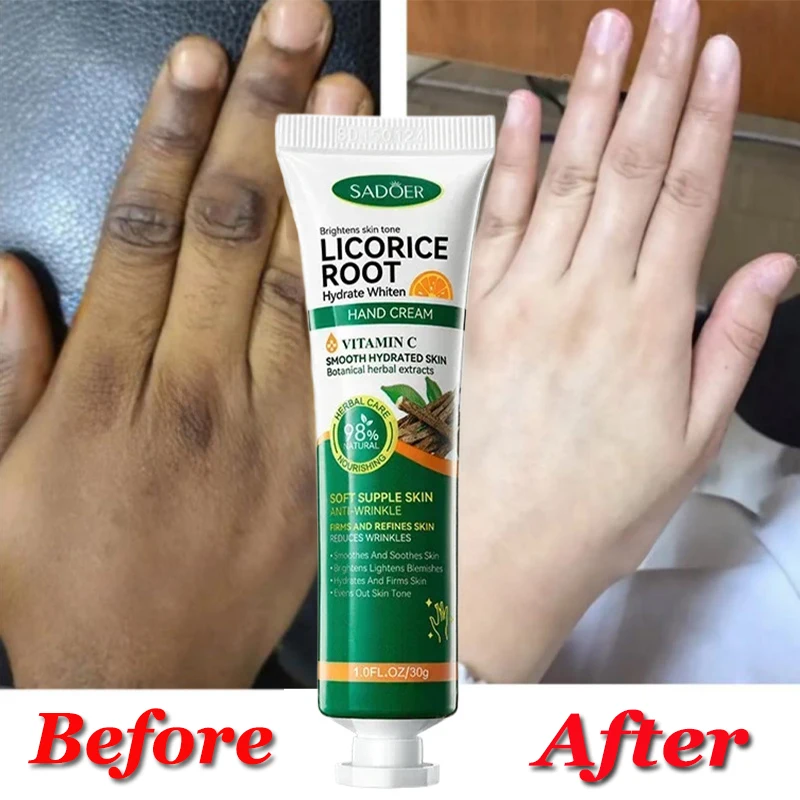 Быстрое отбеливание крем для рук с темными костяшками осветляющий увлажняющий