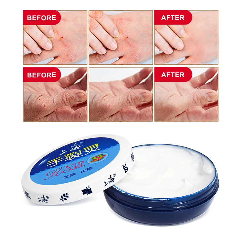 Shanghai Beauty Chapped Skin Hand Care Nourishes Hands Rough